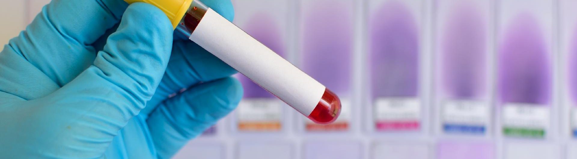 exame-de-sangue-laboratorio-de-analises-clinicas-tubo-de-ensaio-tipo-sanguineo-1476735344347_v2_1920x1280