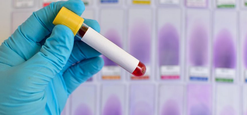 exame-de-sangue-laboratorio-de-analises-clinicas-tubo-de-ensaio-tipo-sanguineo-1476735344347_v2_1920x1280