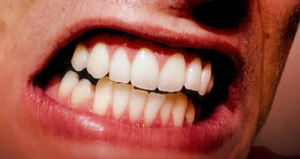 dente-1_alessandro-paiva_sxc_destaque-2-1000x563