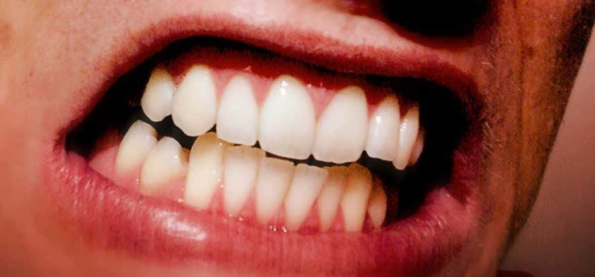 dente-1_alessandro-paiva_sxc_destaque-2-1000x563